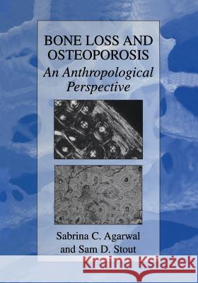 Bone Loss and Osteoporosis: An Anthropological Perspective Agarwal, Sabrina C. 9781461347088