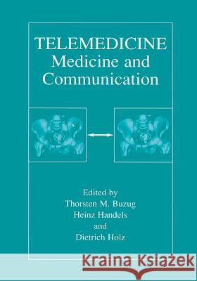 Telemedicine: Medicine and Communication Buzug, Thorsten M. 9781461354635 Springer