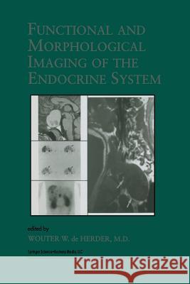 Functional and Morphological Imaging of the Endocrine System W. W. De Herder 9781461369509 Springer