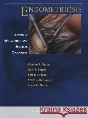 Endometriosis: Advanced Management and Surgical Techniques Nezhat, Camran R. 9781461384069 Springer