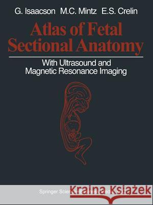 Atlas of Fetal Sectional Anatomy: With Ultrasound and Magnetic Resonance Imaging Isaacson, Glenn 9781461386179 Springer