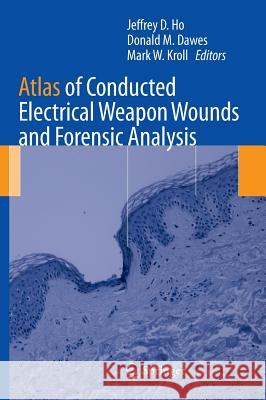 Atlas of Conducted Electrical Weapon Wounds and Forensic Analysis Jeffrey D. Ho Donald M. Dawes Mark W. Kroll 9781461435426 Springer, Berlin