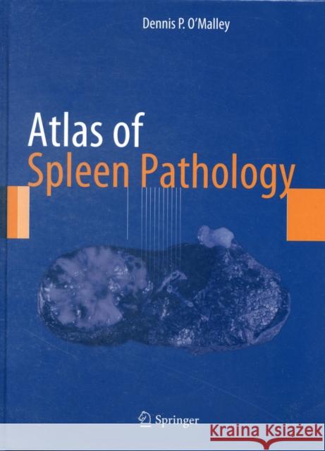 Atlas of Spleen Pathology Dennis O Malley 9781461446712