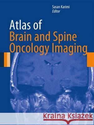 Atlas of Brain and Spine Oncology Imaging Sasan Karimi 9781461456520 Springer