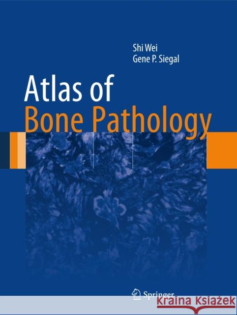 Atlas of Bone Pathology Shi Wei 9781461463269 0