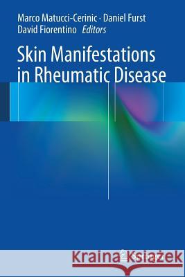 Skin Manifestations in Rheumatic Disease Marco Matucci-Cerinic Daniel Furst David Fiorentino 9781461478485 Springer