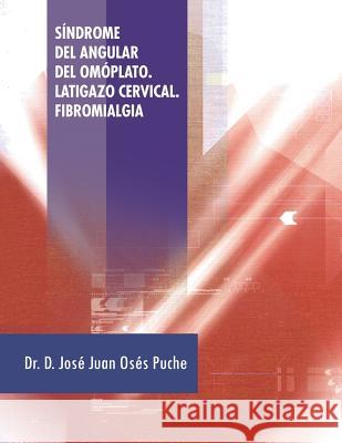 Sindrome del Angular del Omoplato. Latigazo Cervical. Fibromialgia Dr D. Jose Juan Oses Puche 9781463352592 Palibrio