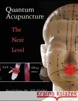 Quantum Acupuncture: - The Next Level Ronald Henr 9781463511210 Createspace