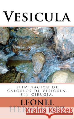 Vesicula: eliminacion de calculos de vesicula, sin cirugia. Hernandez, J. L. 9781466214316 Createspace