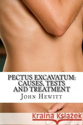 Pectus Excavatum: Causes, Tests and Treatment John Hewit Mohamed Awa 9781466283619 Createspace