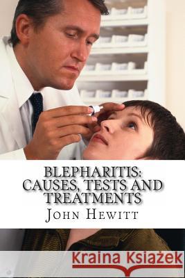 Blepharitis: Causes, Tests and Treatment John Hewit Mohamed Awa 9781466436329 Createspace