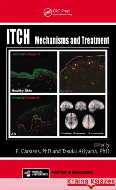 Itch: Mechanisms and Treatment Carstens, E. 9781466505438 CRC Press