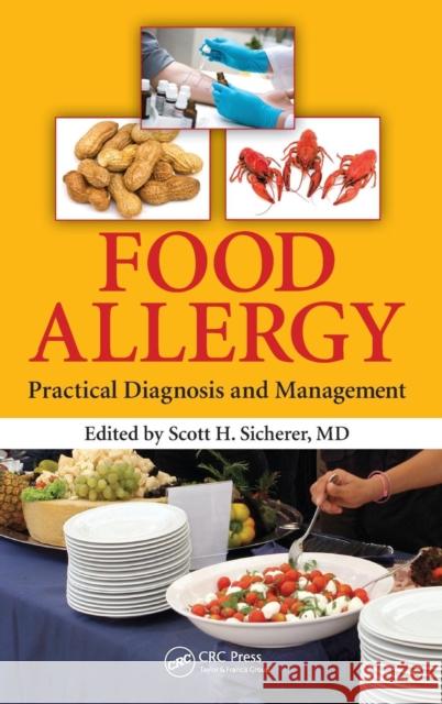 Food Allergy: Practical Diagnosis and Management Sicherer, Scott H. 9781466512689 CRC Press