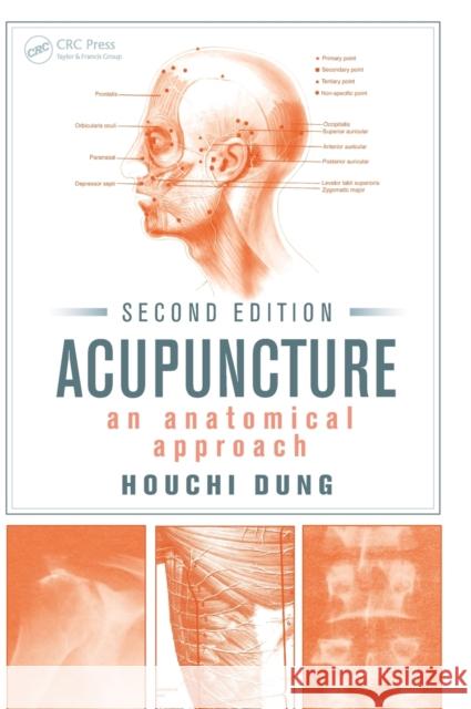 Acupuncture: An Anatomical Approach, Second Edition Dung, Houchi 9781466581920 0