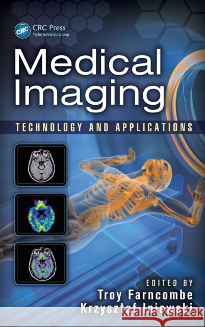Medical Imaging: Technology and Applications Farncombe, Troy 9781466582620 CRC Press