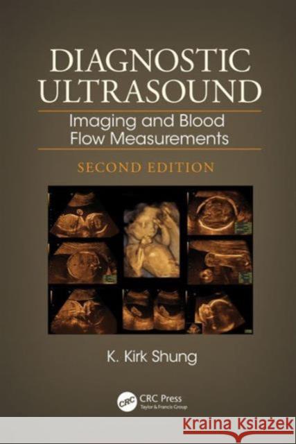 Diagnostic Ultrasound: Imaging and Blood Flow Measurements, Second Edition Shung, K. Kirk 9781466582644 CRC Press