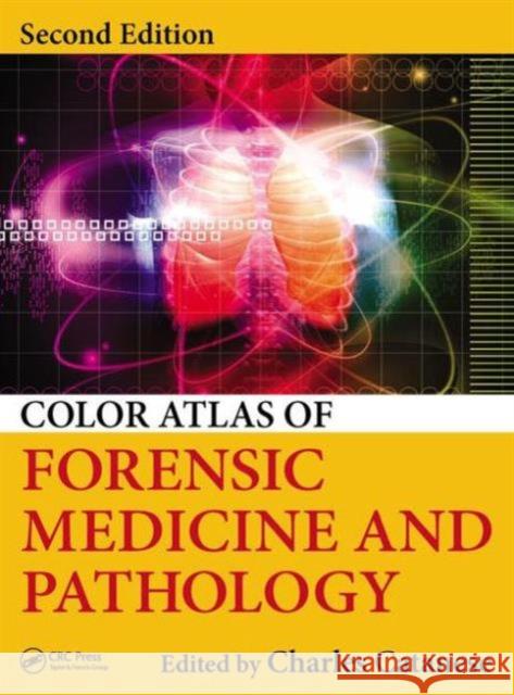 Color Atlas of Forensic Medicine and Pathology Charles Catanese 9781466585904 CRC Press