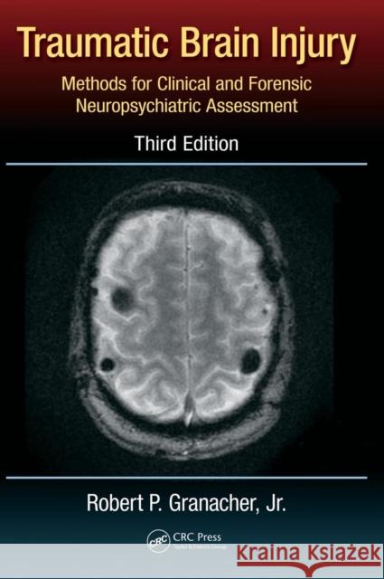 Traumatic Brain Injury: Methods for Clinical and Forensic Neuropsychiatric Assessment, Third Edition Lund, Daryl B. 9781466594807 CRC Press