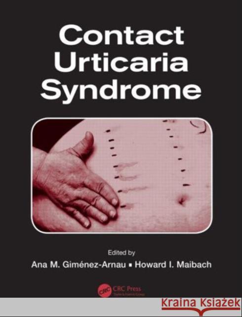 Contact Urticaria Syndrome Ana M. Gimenez-Arnau Howard I. Maibach 9781466598003 CRC Press