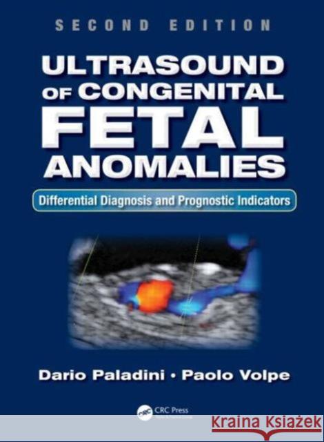 Ultrasound of Congenital Fetal Anomalies: Differential Diagnosis and Prognostic Indicators, Second Edition Paladini, Dario 9781466598966 Taylor & Francis Inc