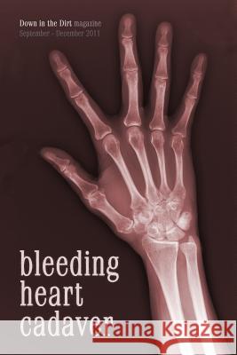 Bleeding Heart Cadaver: Down in the Dirt Magazine September-December 2011 Issue Writings John L. Campbell Lisa Cappiello Jim Carson 9781467910200 Createspace Independent Publishing Platform