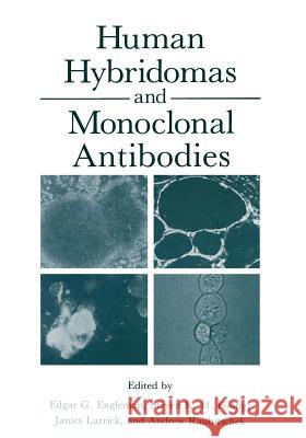 Human Hybridomas and Monoclonal Antibodies Edgar Engleman 9781468449518 Springer