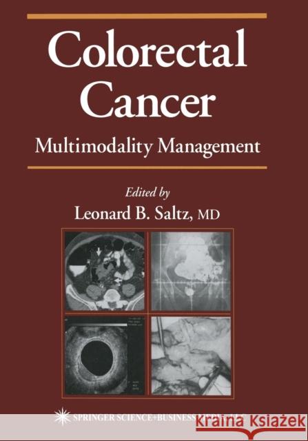 Colorectal Cancer: Multimodality Management Saltz, Leonard B. 9781468496703 Humana Press Inc.