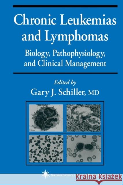 Chronic Leukemias and Lymphomas: Biology, Pathophysiology, and Clinical Management Schiller, Gary J. 9781468497328 Humana Press