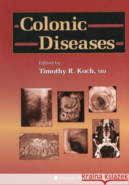 Colonic Diseases Timothy R. Koch 9781468497403