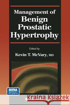 Management of Benign Prostatic Hypertrophy Kevin T. McVary 9781468498066 Humana Press