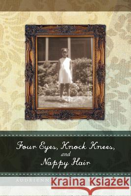 Four Eyes, Knock Knees, and Nappy Hair Audrienne Roberts Womack 9781469132006 Xlibris Corporation