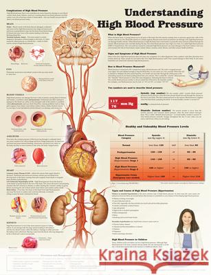 Understanding High Blood Pressure Anatomical Chart Company   9781469872889 Lippincott Williams and Wilkins