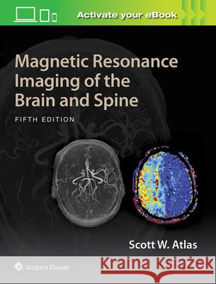 Magnetic Resonance Imaging of the Brain and Spine Atlas, Scott W. 9781469873206 LWW