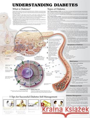Understanding Diabetes Anatomical Chart Anatomical Chart Company Jeff Unger, M.D.  9781469894898 Lippincott Williams and Wilkins
