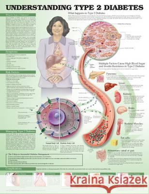 Understanding Type 2 Diabetes Anatomical Chart Anatomical Chart Company                 Jeff Unger 9781469894980 Acc Books