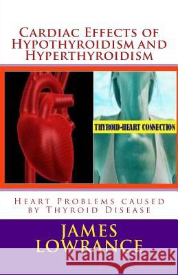 Cardiac Effects of Hypothyroidism and Hyperthyroidism: Heart Problems caused by Thyroid Disease Lowrance, James M. 9781469996936 Createspace