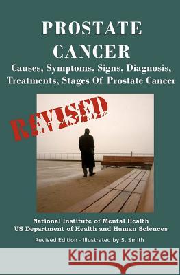 Prostate Cancer: Causes, Symptoms, Signs, Diagnosis, Treatments, Stages. What You Need to Know About Prostate Cancer Department of Health and Human Services 9781470033750 Createspace