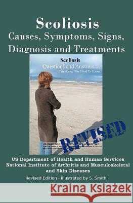 Scoliosis: Revised Edition: Causes, Symptoms, Signs, Diagnosis and Treatments Institutes of Health National Institute  S. Smith S. Smith 9781470051938 Createspace