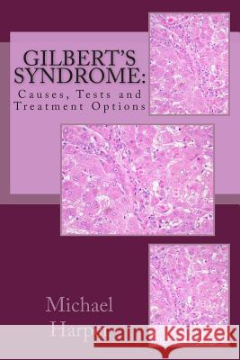 Gilbert's Syndrome: Causes, Tests and Treatment Options Michael J. Harpe J. R. Hernande 9781470195311 Createspace