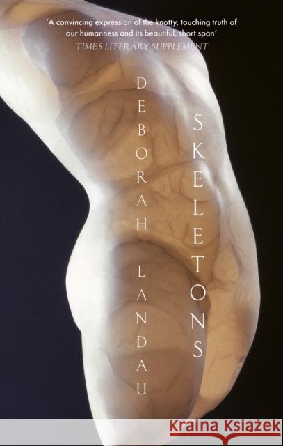 Skeletons Deborah Landau 9781472158994