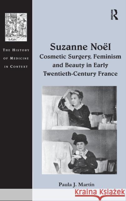 Suzanne Noël: Cosmetic Surgery, Feminism and Beauty in Early Twentieth-Century France Martin, Paula J. 9781472411884