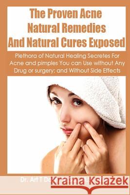 The Proven Acne Natural Remedies And Natural Cures Exposed: Plethora Of Natural Healing Secretes For Acne and Pimples You Can Use Without Any Drug or Dash, M. Sc M. S. Ph. D. Art T. 9781475113402 Createspace