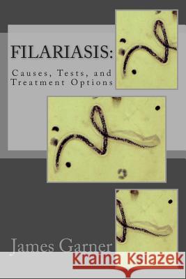 Filariasis: Causes, Tests, and Treatment Options James P. Garne Leonard Stanle 9781475154887