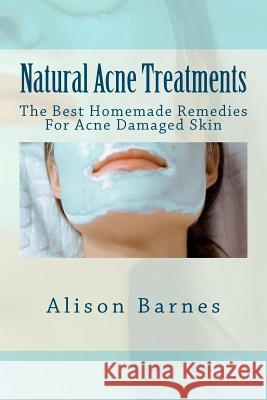 Natural Acne Treatments: The Best Homemade Remedies For Acne Damaged Skin Barnes, Alison 9781475222227 Createspace