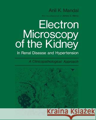 Electron Microscopy of the Kidney: In Renal Disease and Hypertension: A Clinicopathological Approach Mandal, Anil K. 9781475717013 Springer