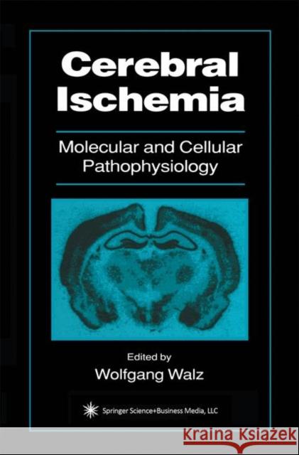 Cerebral Ischemia: Molecular and Cellular Pathophysiology Walz, Wolfgang 9781475747355