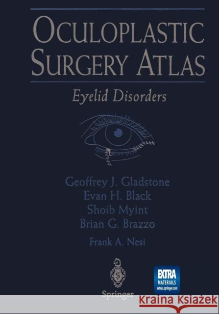 Oculoplastic Surgery Atlas: Eyelid Disorders Hengst, T. C. 9781475760590 Springer
