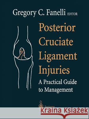 Posterior Cruciate Ligament Injuries: A Practical Guide to Management Fanelli, Gregory C. 9781475762167 Springer