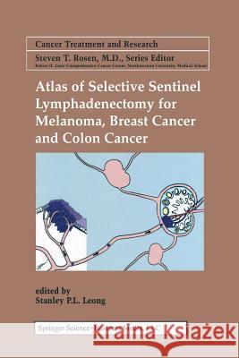 Atlas of Selective Sentinel Lymphadenectomy for Melanoma, Breast Cancer and Colon Cancer Stanley P. L. Leong 9781475776317