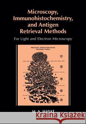 Microscopy, Immunohistochemistry, and Antigen Retrieval Methods: For Light and Electron Microscopy Hayat, M. A. 9781475776331 Springer